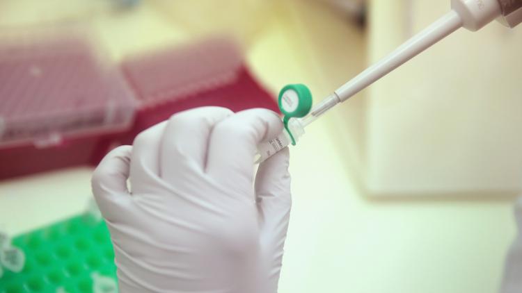 vaccin, sida crédit : SCOTT OLSON / GETTY IMAGES NORTH AMERICA / AFP - 1280